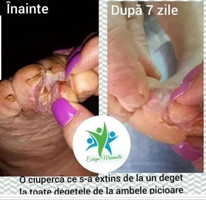 Plafar naturist